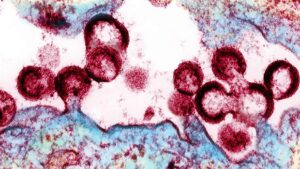 VIH-cells-kK0G--620x349@abc